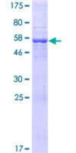 Novus Biologicals Recombinant Human TRDV2 GST (N-Term) Protein 10 &mu;g | Buy Online | Novus Biologicals&trade; | Fisher Scientific