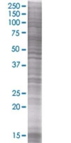 Novus Biologicals TRDD3 293T Cell Transient Overexpression Lysate 0.1 mL | Buy Online | Novus Biologicals&trade; | Fisher Scientific
