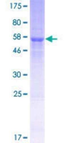 Novus Biologicals Recombinant Human TRBV19 GST (N-Term) Protein 25 &mu;g | Buy Online | Novus Biologicals&trade; | Fisher Scientific
