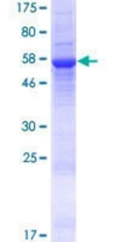 Novus Biologicals Recombinant Human TRBV3-1 GST (N-Term) Protein 10 &mu;g | Buy Online | Novus Biologicals&trade; | Fisher Scientific