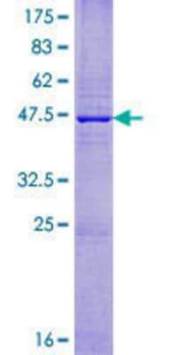 Novus Biologicals Recombinant Human IGLV6-57 GST (N-Term) Protein 25 &mu;g | Buy Online | Novus Biologicals&trade; | Fisher Scientific