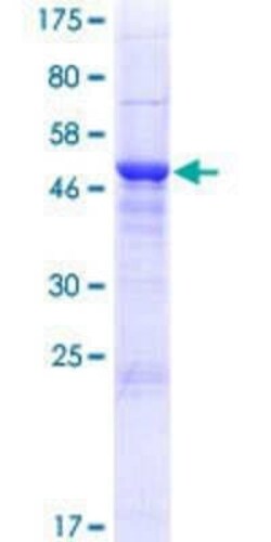 Novus Biologicals Recombinant Human IGLV4-3 GST (N-Term) Protein 25 &mu;g | Buy Online | Novus Biologicals&trade; | Fisher Scientific