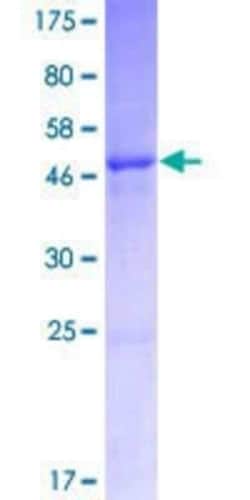 Novus Biologicals Recombinant Human IGLV3-21 GST (N-Term) Protein 10 &mu;g | Buy Online | Novus Biologicals&trade; | Fisher Scientific