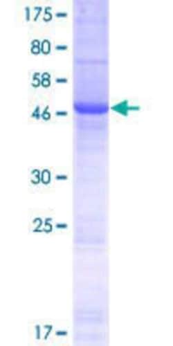 Novus Biologicals Recombinant Human IGLV2-14 GST (N-Term) Protein 10 &mu;g | Buy Online | Novus Biologicals&trade; | Fisher Scientific