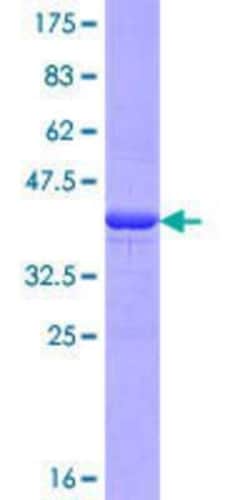 Novus Biologicals Recombinant Human IGKV1OR2-108 GST (N-Term) Protein 10 &mu;g | Buy Online | Novus Biologicals&trade; | Fisher Scientific