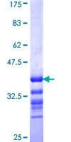 Novus Biologicals Recombinant Human TRIB2 GST (N-Term) Protein 25 &mu;g | Buy Online | Novus Biologicals&trade; | Fisher Scientific