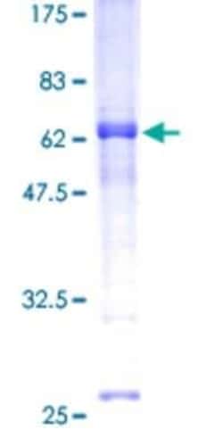 Novus Biologicals Recombinant Human REM1 GST (N-Term) Protein 25 &mu;g | Buy Online | Novus Biologicals&trade; | Fisher Scientific