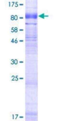 Novus Biologicals Recombinant Human SLC6A16 GST (N-Term) Protein 10 &mu;g | Buy Online | Novus Biologicals&trade; | Fisher Scientific