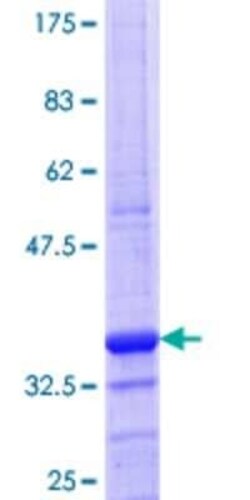 Novus Biologicals Recombinant Human SLC6A16 GST (N-Term) Protein 25 &mu;g | Buy Online | Novus Biologicals&trade; | Fisher Scientific