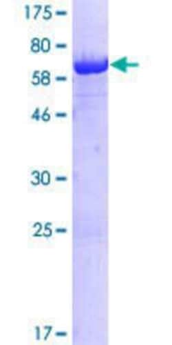 Novus Biologicals Recombinant Human BZW2 GST (N-Term) Protein 25 &mu;g | Buy Online | Novus Biologicals&trade; | Fisher Scientific