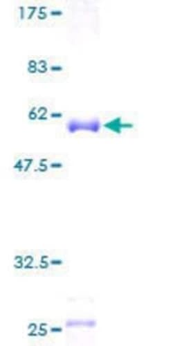 Novus Biologicals Recombinant Human MRPS18B GST (N-Term) Protein 25 &mu;g | Buy Online | Novus Biologicals&trade; | Fisher Scientific