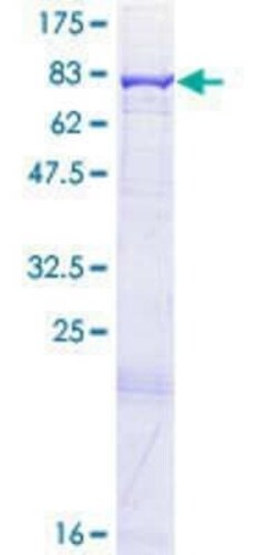 Novus Biologicals Recombinant Human ACAD9 GST (N-Term) Protein 25 &mu;g | Buy Online | Novus Biologicals&trade; | Fisher Scientific