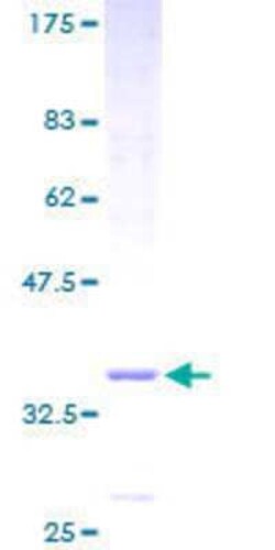 Novus Biologicals Recombinant Human TMEM14A GST (N-Term) Protein 25 &mu;g | Buy Online | Novus Biologicals&trade; | Fisher Scientific