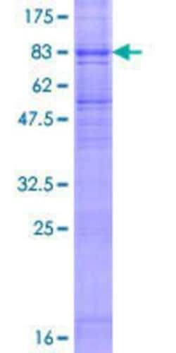 Novus Biologicals Recombinant Human FLVCR GST (N-Term) Protein 10 &mu;g | Buy Online | Novus Biologicals&trade; | Fisher Scientific