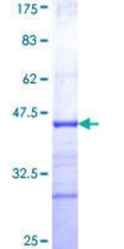 Novus Biologicals Recombinant Human FLVCR GST (N-Term) Protein 25 &mu;g | Buy Online | Novus Biologicals&trade; | Fisher Scientific