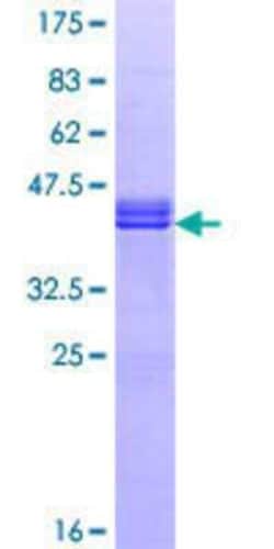 Novus Biologicals Recombinant Human RGC32 GST (N-Term) Protein 25 &mu;g | Buy Online | Novus Biologicals&trade; | Fisher Scientific
