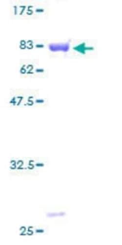 Novus Biologicals Recombinant Human HIP-55 GST (N-Term) Protein 10 &mu;g | Buy Online | Novus Biologicals&trade; | Fisher Scientific