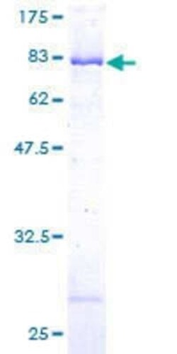 Novus Biologicals Recombinant Human HIP-55 GST (N-Term) Protein 10 &mu;g | Buy Online | Novus Biologicals&trade; | Fisher Scientific