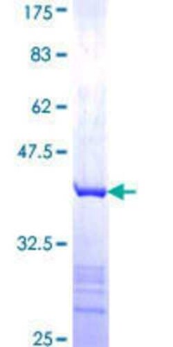 Novus Biologicals Recombinant Human COMMD5 GST (N-Term) Protein 10 &mu;g | Buy Online | Novus Biologicals&trade; | Fisher Scientific