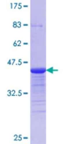 Novus Biologicals Recombinant Human HIPK2 GST (N-Term) Protein 25 &mu;g | Buy Online | Novus Biologicals&trade; | Fisher Scientific