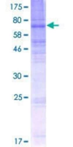 Novus Biologicals Recombinant Human SLC43A3 GST (N-Term) Protein 2 &mu;g | Buy Online | Novus Biologicals&trade; | Fisher Scientific