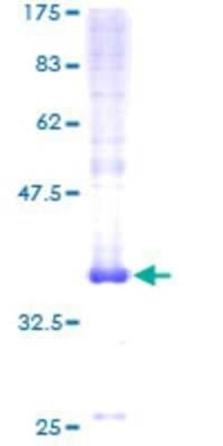 Novus Biologicals Recombinant Human TMEM230 GST (N-Term) Protein 10 &mu;g | Buy Online | Novus Biologicals&trade; | Fisher Scientific