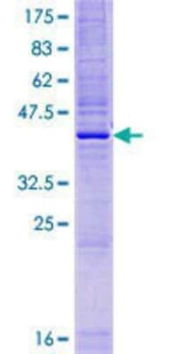 Novus Biologicals Recombinant Human HSPC047 GST (N-Term) Protein 10 &mu;g | Buy Online | Novus Biologicals&trade; | Fisher Scientific