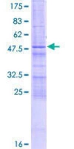 Novus Biologicals Recombinant Human ZCCHC4 GST (N-Term) Protein 10 &mu;g | Buy Online | Novus Biologicals&trade; | Fisher Scientific