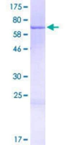 Novus Biologicals Recombinant Human CCDC113 GST (N-Term) Protein 2 &mu;g | Buy Online | Novus Biologicals&trade; | Fisher Scientific