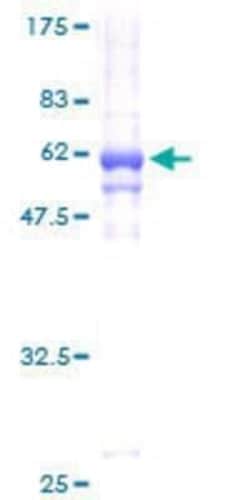 Novus Biologicals Recombinant Human C1GALT1C1 GST (N-Term) Protein 2 &mu;g | Buy Online | Novus Biologicals&trade; | Fisher Scientific