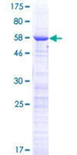 Novus Biologicals Recombinant Human CCDC59 GST (N-Term) Protein 25 &mu;g | Buy Online | Novus Biologicals&trade; | Fisher Scientific