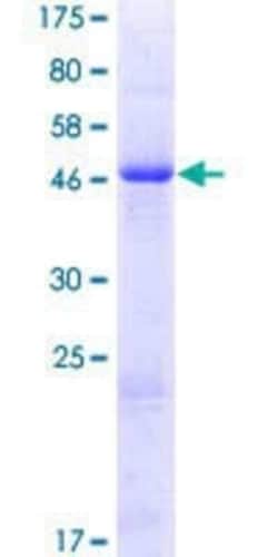 Novus Biologicals Recombinant Human Methyltransferase like 5 GST (N-Term) Protein 25 &mu;g | Buy Online | Novus Biologicals&trade; | Fisher Scientific