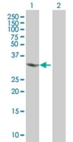 Novus Biologicals CHMP4A 293T Cell Transient Overexpression Lysate 0.1 mL | Buy Online | Novus Biologicals&trade; | Fisher Scientific