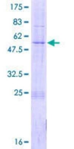Novus Biologicals Recombinant Human TIM21 GST (N-Term) Protein 2 &mu;g | Buy Online | Novus Biologicals&trade; | Fisher Scientific