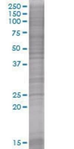 Novus Biologicals MRPL22 293T Cell Transient Overexpression Lysate 0.1 mL | Buy Online | Novus Biologicals&trade; | Fisher Scientific