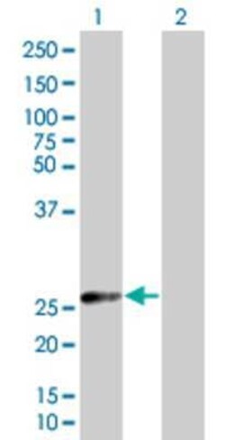 Novus Biologicals MRPL22 293T Cell Transient Overexpression Lysate 0.1 mL | Buy Online | Novus Biologicals&trade; | Fisher Scientific