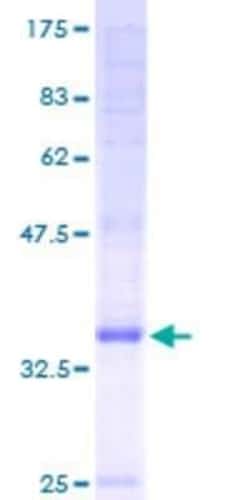 Novus Biologicals Recombinant Human CNIH4 GST (N-Term) Protein 25 &mu;g | Buy Online | Novus Biologicals&trade; | Fisher Scientific