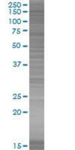 Novus Biologicals FHOD1 293T Cell Transient Overexpression Lysate 0.1 mL | Buy Online | Novus Biologicals&trade; | Fisher Scientific