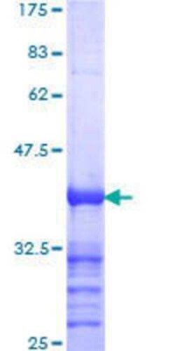 Novus Biologicals Recombinant Human TBK1 GST (N-Term) Protein 25 &mu;g | Buy Online | Novus Biologicals&trade; | Fisher Scientific