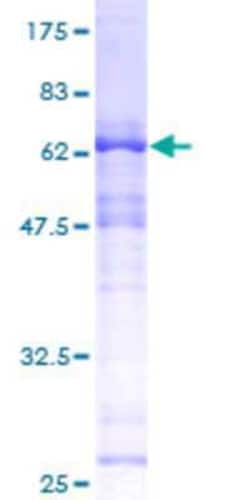 Novus Biologicals Recombinant Human SAP30BP GST (N-Term) Protein 2 &mu;g | Buy Online | Novus Biologicals&trade; | Fisher Scientific
