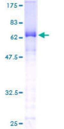 Novus Biologicals Recombinant Human CTNNA3 GST (N-Term) Protein 25 &mu;g | Buy Online | Novus Biologicals&trade; | Fisher Scientific