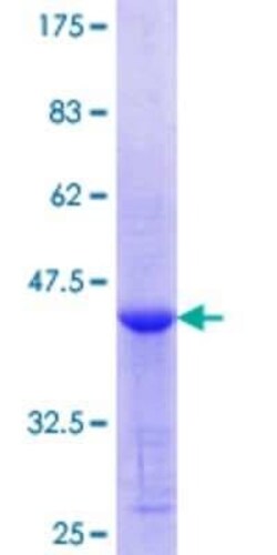 Novus Biologicals Recombinant Human TSP50 GST (N-Term) Protein 25 &mu;g | Buy Online | Novus Biologicals&trade; | Fisher Scientific