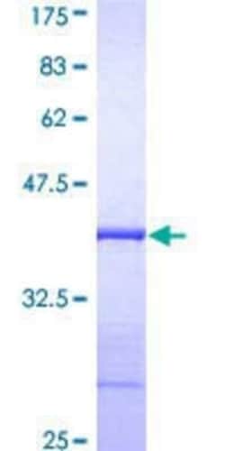 Novus Biologicals Recombinant Human MgcRacGAP/RACGAP1 GST (N-Term) Protein 25 &mu;g | Buy Online | Novus Biologicals&trade; | Fisher Scientific