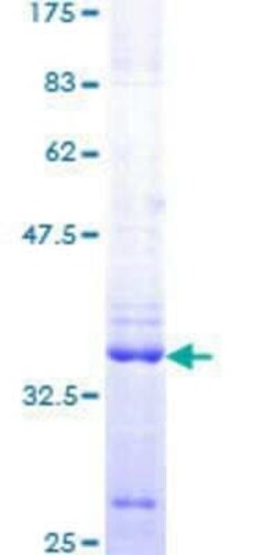 Novus Biologicals Recombinant Human UHRF1 GST (N-Term) Protein 10 &mu;g | Buy Online | Novus Biologicals&trade; | Fisher Scientific