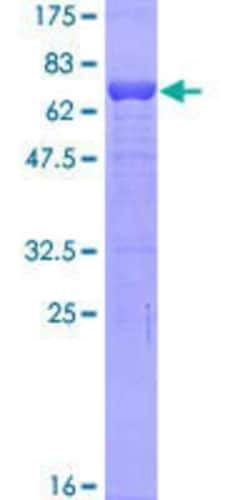 Novus Biologicals Recombinant Human Tropomodulin 2 GST (N-Term) Protein 10 &mu;g | Buy Online | Novus Biologicals&trade; | Fisher Scientific