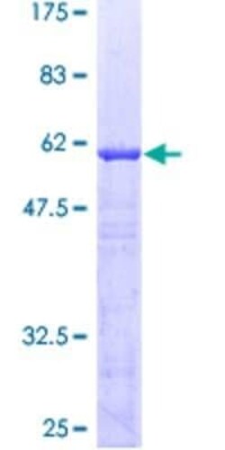 Novus Biologicals Recombinant Human ABT1 GST (N-Term) Protein 10 &mu;g | Buy Online | Novus Biologicals&trade; | Fisher Scientific