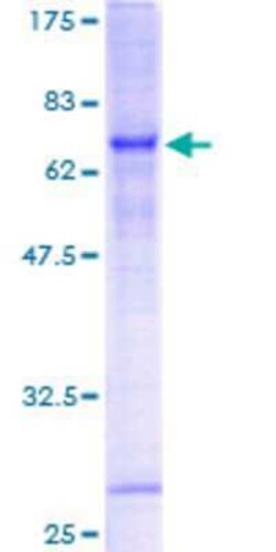 Novus Biologicals Recombinant Human PARVB GST (N-Term) Protein 10 &mu;g | Buy Online | Novus Biologicals&trade; | Fisher Scientific