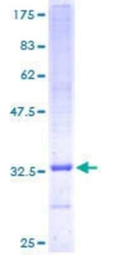 Novus Biologicals Recombinant Human UQCR10 GST (N-Term) Protein 25 &mu;g | Buy Online | Novus Biologicals&trade; | Fisher Scientific