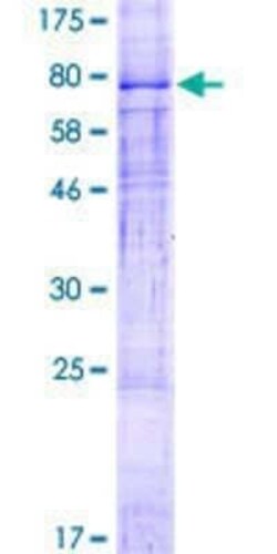 Novus Biologicals Recombinant Human ZDHHC1 GST (N-Term) Protein 2 &mu;g | Buy Online | Novus Biologicals&trade; | Fisher Scientific