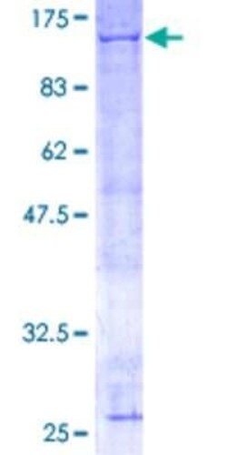 Novus Biologicals Recombinant Human ANAPC2 GST (N-Term) Protein 25 &mu;g | Buy Online | Novus Biologicals&trade; | Fisher Scientific